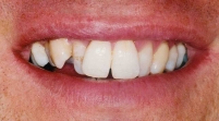 Jamie Norton Dental Case Study2