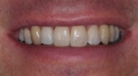 Jamie Norton Dental Case Study3