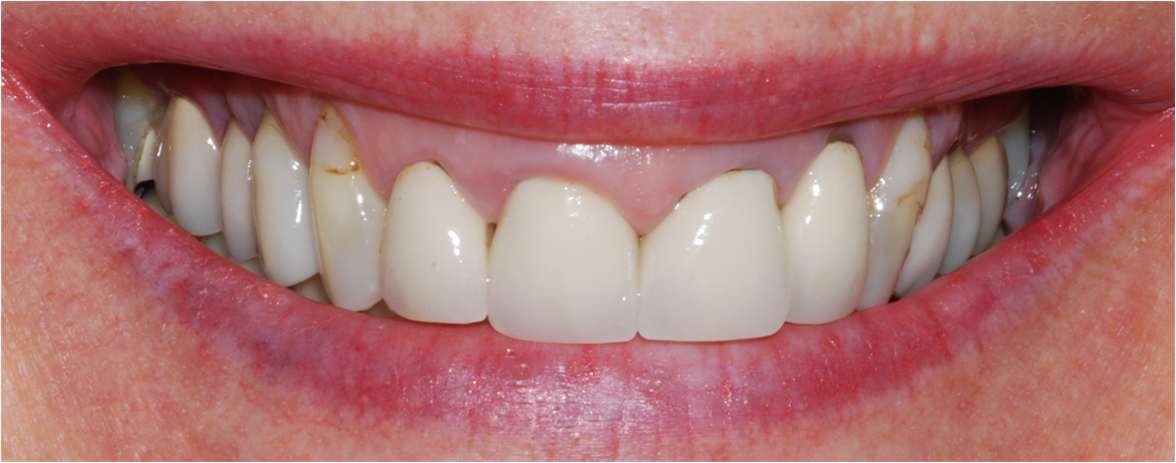 Lynette Herd Dental Case Study2