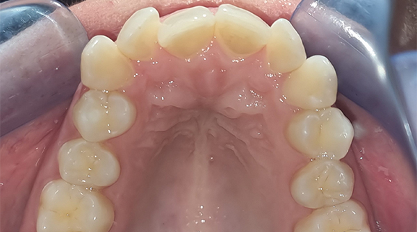 Before - The Beresford Dental Clinic