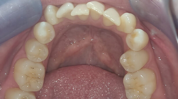 Before - The Beresford Dental Clinic