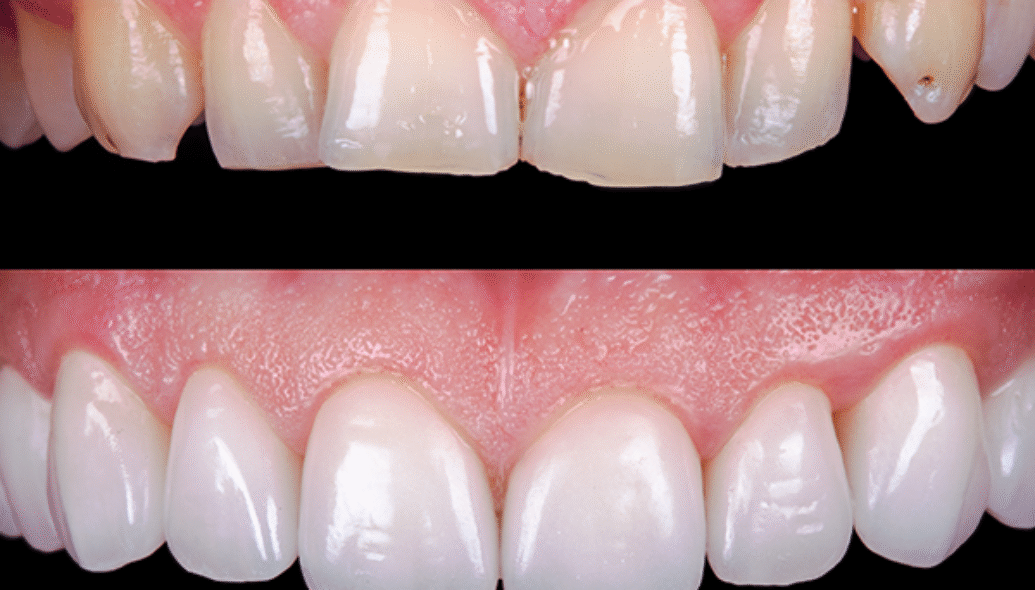 Blog Inner - The Beresford Dental Clinic