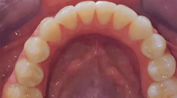 After - The Beresford Dental Clinic