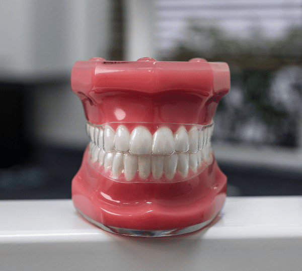 Treatment - The Beresford Dental Clinic