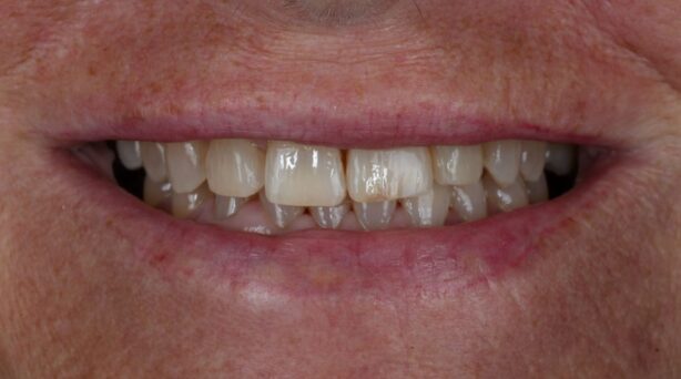 Before - The Beresford Dental Clinic