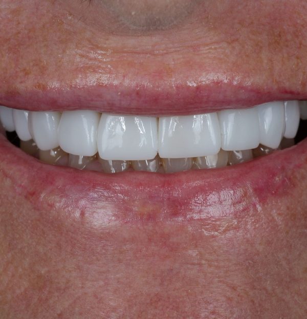 Blog - The Beresford Dental Clinic