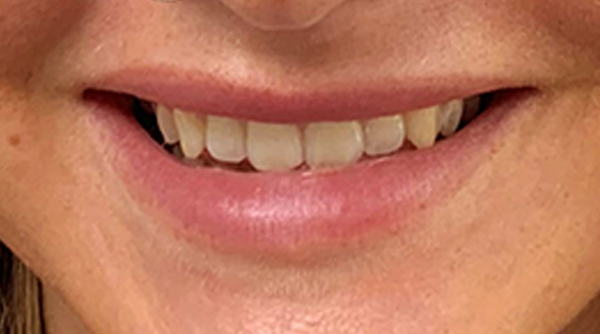 Before - The Beresford Dental Clinic