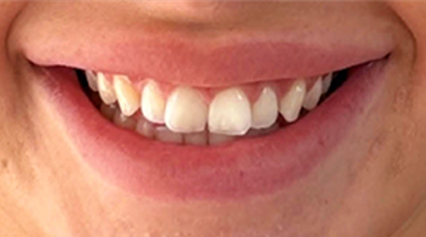Before - The Beresford Dental Clinic