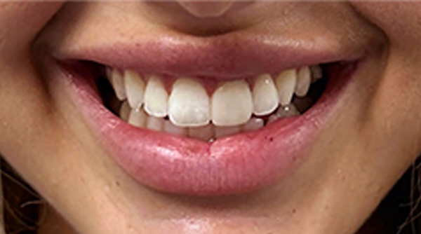Before - The Beresford Dental Clinic