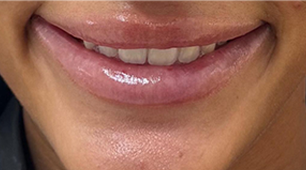 Before - The Beresford Dental Clinic
