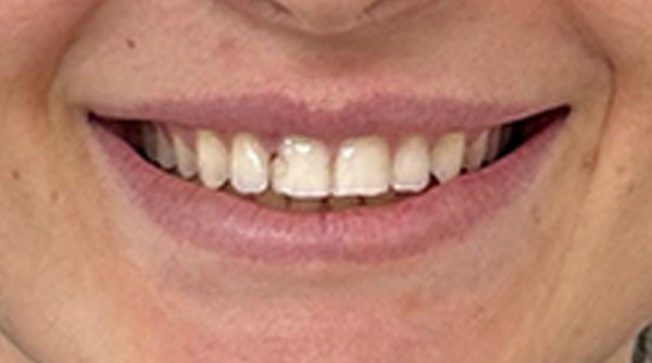 Before - The Beresford Dental Clinic