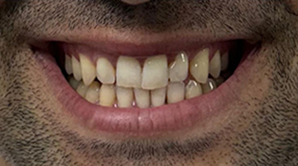 Before - The Beresford Dental Clinic