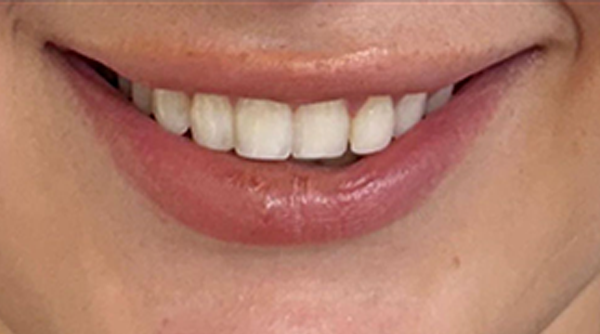 Before - The Beresford Dental Clinic