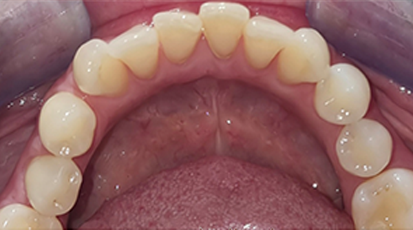After - The Beresford Dental Clinic
