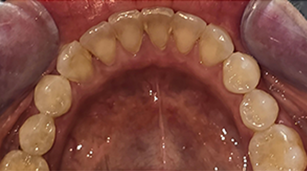 Before - The Beresford Dental Clinic