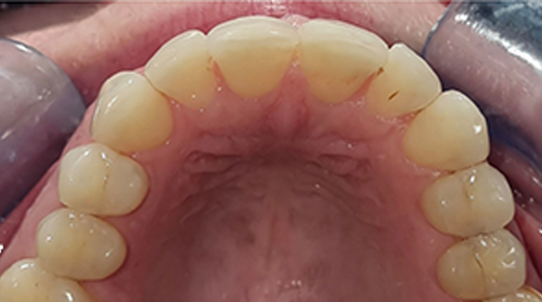After - The Beresford Dental Clinic