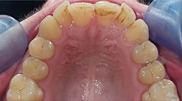 Before - The Beresford Dental Clinic