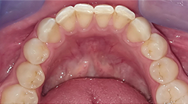 Before - The Beresford Dental Clinic