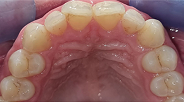 Before - The Beresford Dental Clinic
