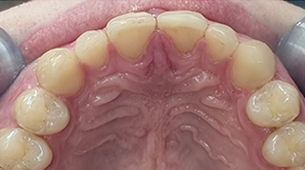 After - The Beresford Dental Clinic