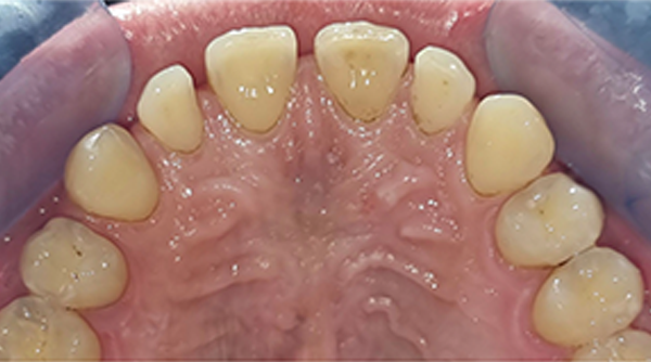 Before - The Beresford Dental Clinic