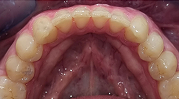 After - The Beresford Dental Clinic