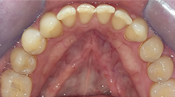 Before - The Beresford Dental Clinic