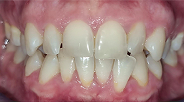 Before - The Beresford Dental Clinic