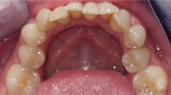 Before - The Beresford Dental Clinic