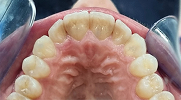 After - The Beresford Dental Clinic