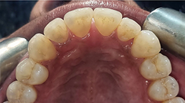 After - The Beresford Dental Clinic