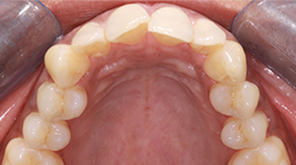 Before - The Beresford Dental Clinic