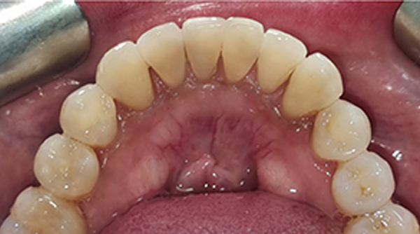 After - The Beresford Dental Clinic