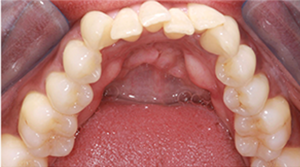 Before - The Beresford Dental Clinic