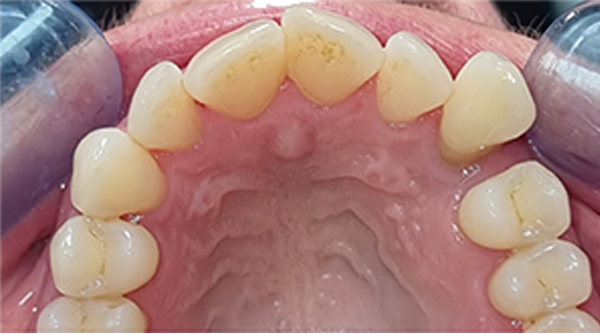 Before - The Beresford Dental Clinic