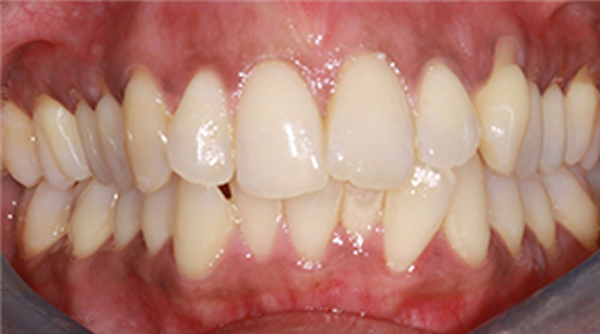 Before - The Beresford Dental Clinic