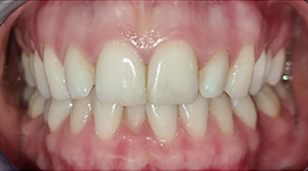 Before - The Beresford Dental Clinic