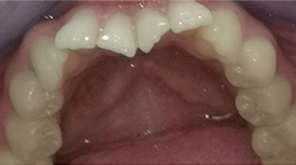 Before - The Beresford Dental Clinic