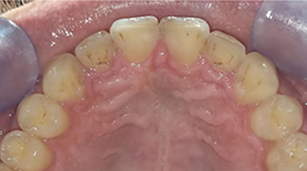After - The Beresford Dental Clinic