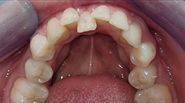 Before - The Beresford Dental Clinic