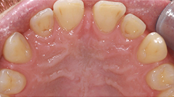 Before - The Beresford Dental Clinic