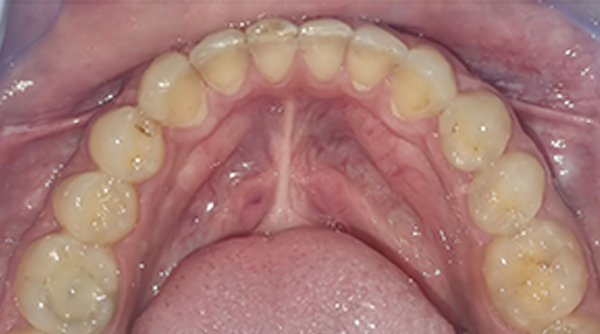 After - The Beresford Dental Clinic