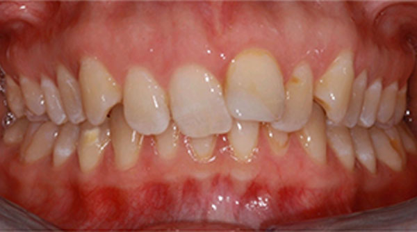 Before - The Beresford Dental Clinic