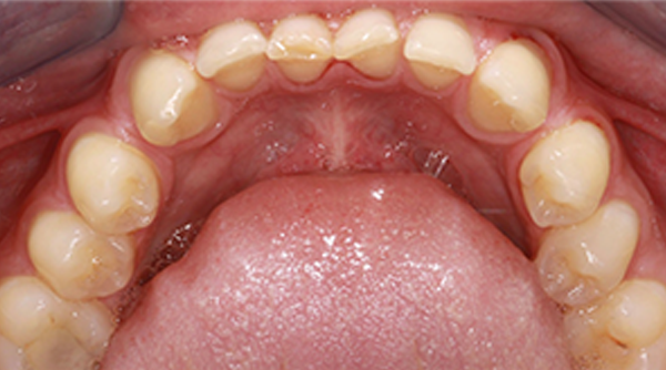 Before - The Beresford Dental Clinic