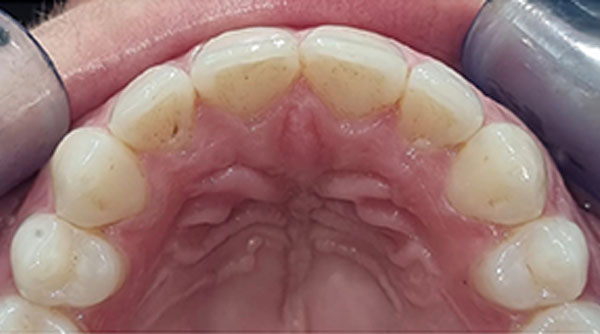 After - The Beresford Dental Clinic