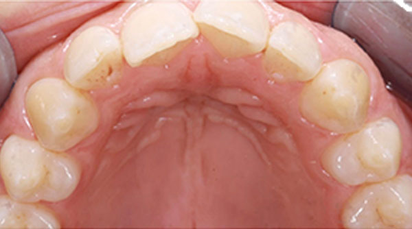 Before - The Beresford Dental Clinic