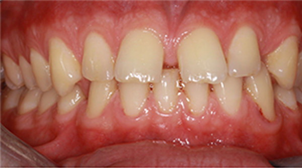 Before - The Beresford Dental Clinic