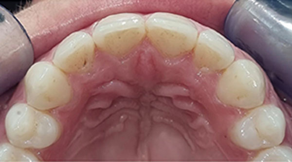 After - The Beresford Dental Clinic