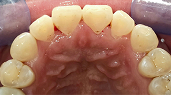 After - The Beresford Dental Clinic