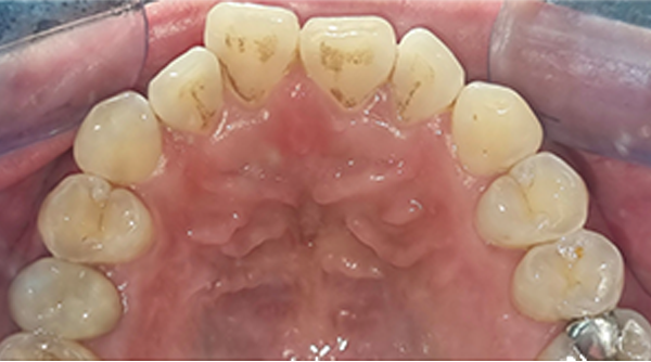Before - The Beresford Dental Clinic